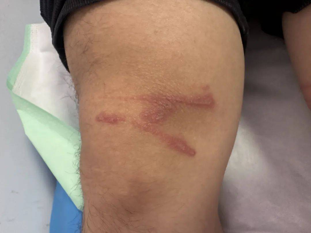 提前进入活跃期！武汉有医院一天接诊20例，重要提醒