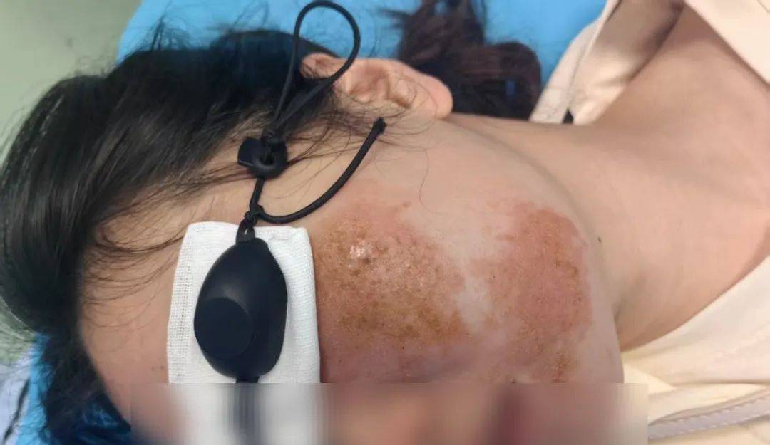 提前进入活跃期！武汉有医院一天接诊20例，重要提醒